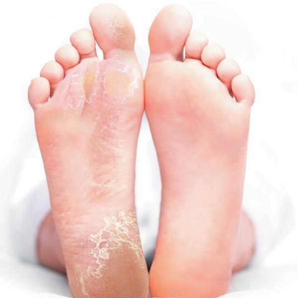 Baby Feet Exfoliating Foot Mask